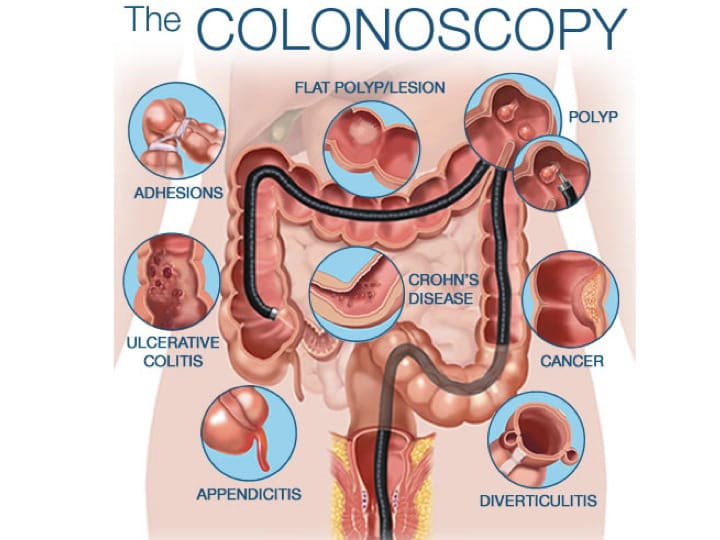Dr. Chirag explaining colonoscopy to patient