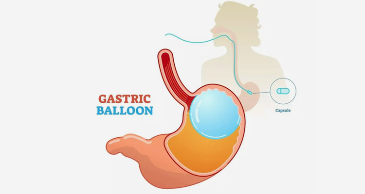 best gastroenterologist hospital in ahmedabad