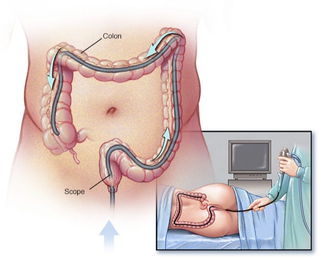 best colonoscopy doctors in ahmedabad