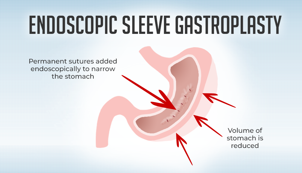 ercp in ahmedabad