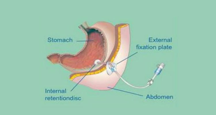 liver hospital in ahmedabad