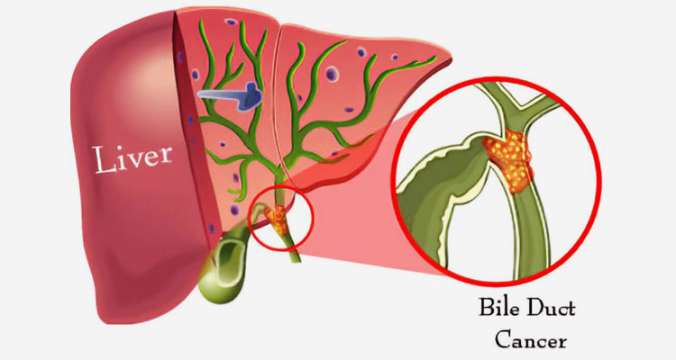 ercp in ahmedabad