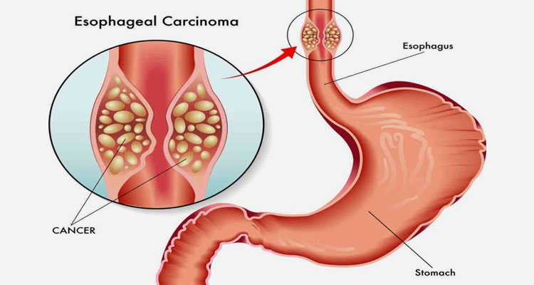 ercp in ahmedabad