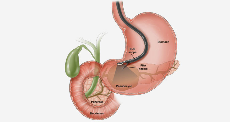 best gastroenterologist hospital in ahmedabad