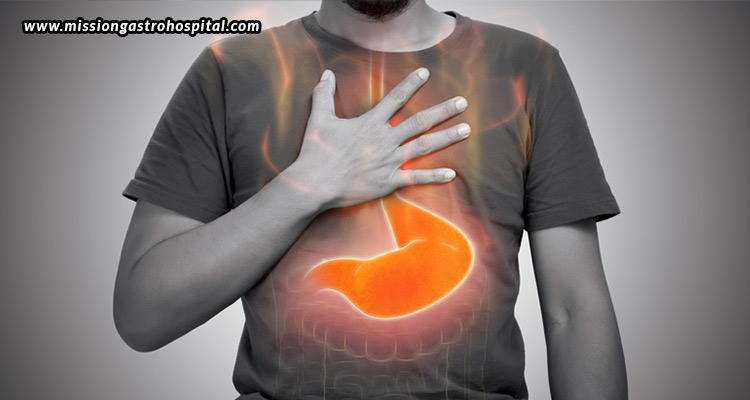 Managing-Acid-Reflux-Lifestyle-Tips-And-Treatment-Options