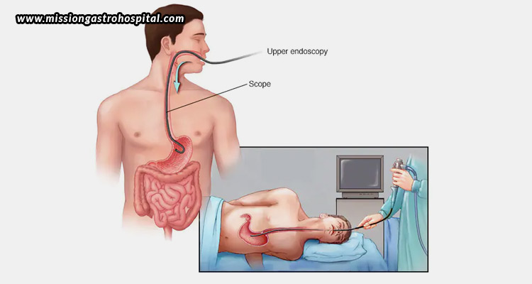 Everything-You-Need-To-Know-About-Endoscopy