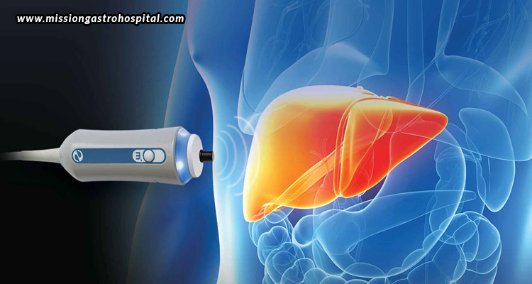 Exploring Fibroscan® Liver Scan – A Comprehensive Guide To Non-invasive 