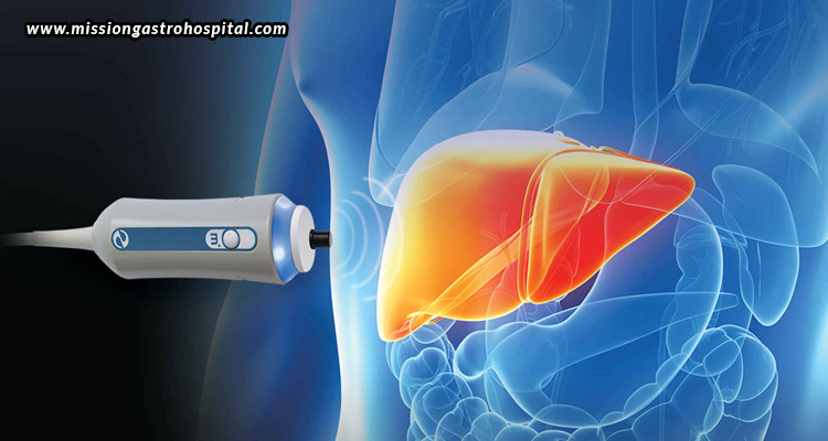 FibroScan-Managing-Chronic-Liver-Diseases-With-Precision-And-Ease