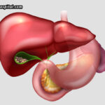 Gallstones-Symptoms-Treatment-And-Prevention