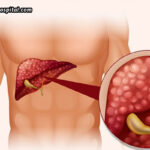 Liver-Function-Tests-(LFTs)-What-They-Reveal-About-Your-Health