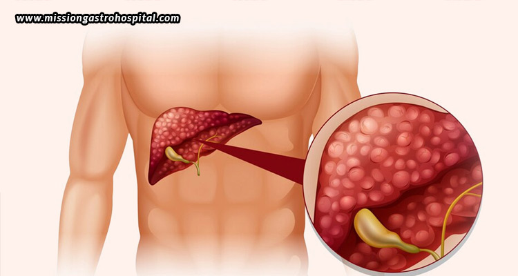 Liver-Function-Tests-(LFTs)-What-They-Reveal-About-Your-Health