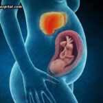 Caring-For-Your-Liver-During-Pregnancy-Risks,-Symptoms-&-Precautions