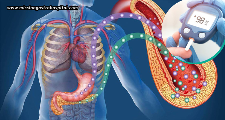 Gut-Health-And-Diabetes-How-Digestion-Affects-Blood-Sugar-Levels
