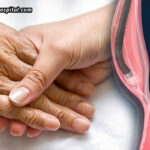 POEM-Treatment-For-Elderly-Patients