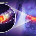 Colonoscopy-And-Cancer-Prevention