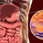 Helicobacter-Pylori-The-Bacteria-That-May-Be-Causing-Stomach-Discomfort