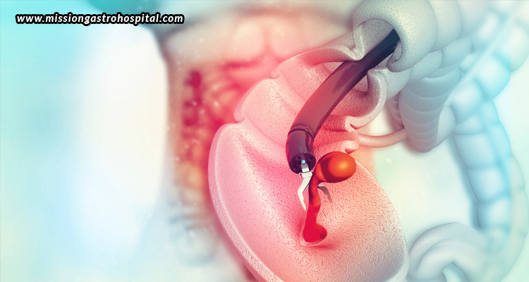 Choosing-The-Right-Gastroenterologist-For-Your-Colonoscopy