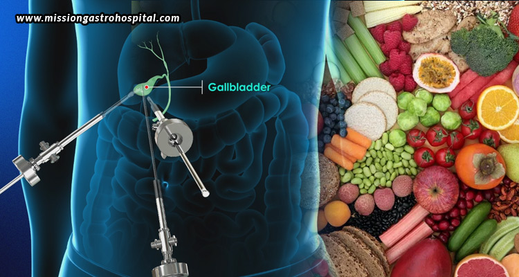Diet-After-Gallbladder-Removal-What-to-Eat,-Avoid-&-Recover-Faster
