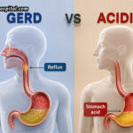 Acidity-vs-GERD-How-to-Know-When-You-Need-a-Gastroenterologist-in-Ahmedabad