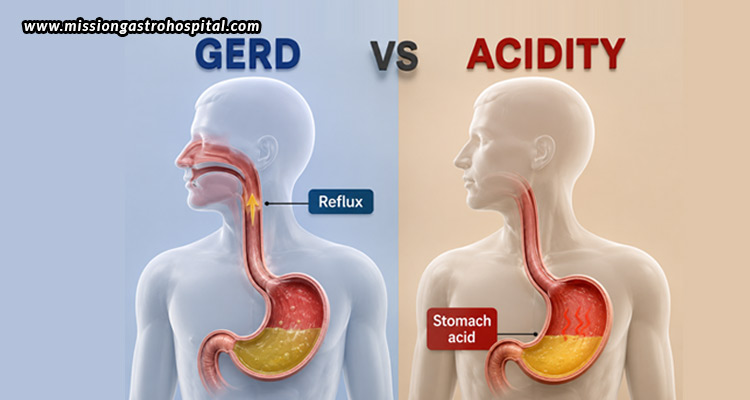 Acidity-vs-GERD-How-to-Know-When-You-Need-a-Gastroenterologist-in-Ahmedabad