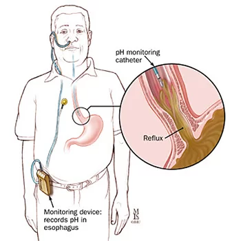 gastro doctor ahmedabad