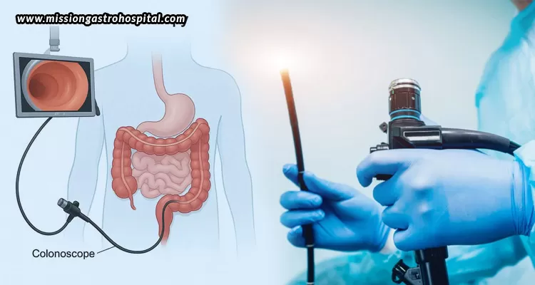Colonoscopy-Age-Appropriate-Screening-Guidelines