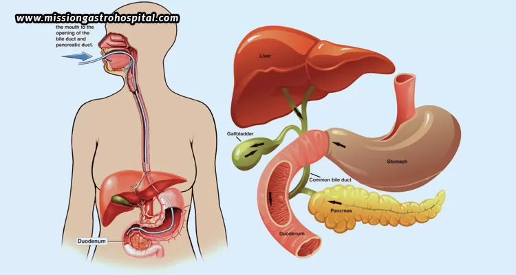 Top-Signs-You-Might-Need-ERCP