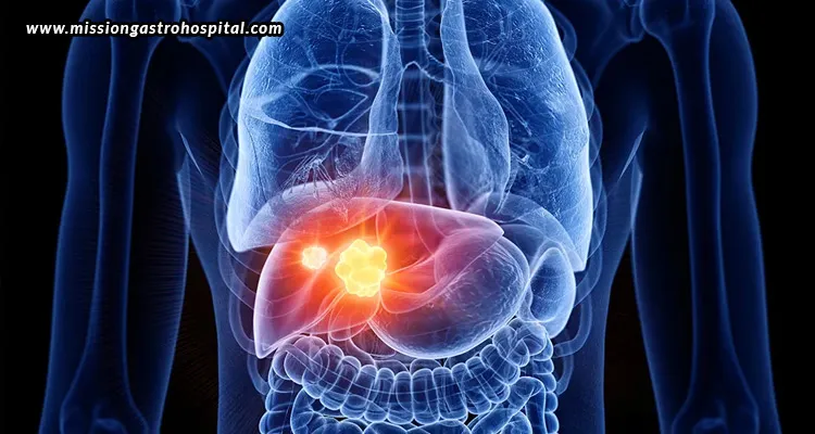 Can-Liver-Disease-Be-Reversed