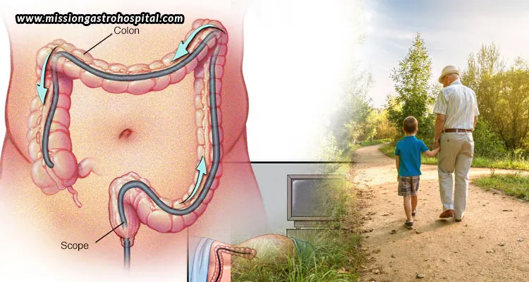Life-After-Colonoscopy