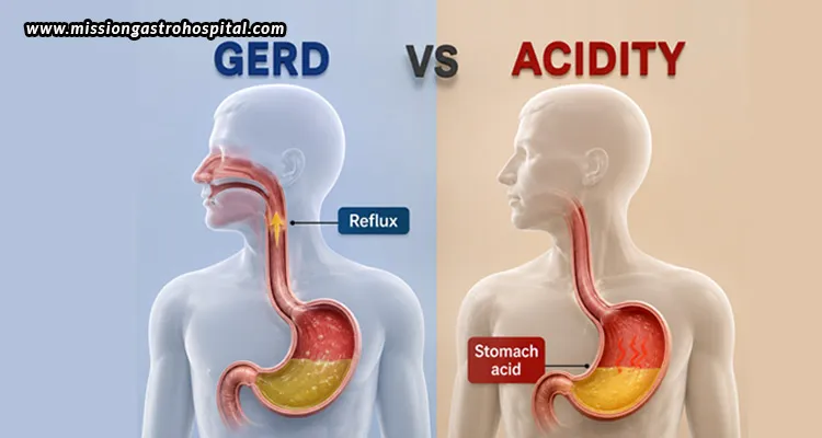 Acidity-vs-GERD-How-to-Know-When-You-Need-a-Gastroenterologist-in-Ahmedabad